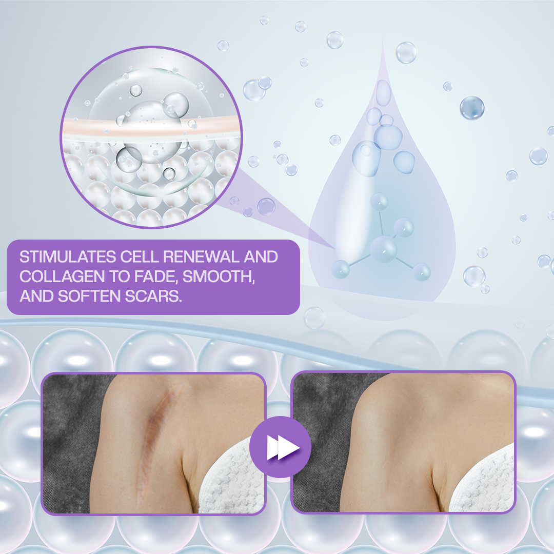 LOVILDS® RevivaDerma Face & Body Scar Gel - Clinically proven to soften, flatten and fade surgical scars, acne marks, burns, keloids and trauma-related scars